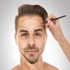 Face Plastic Surgery in Pakistan