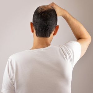 Cure For Hair Restoration in Islamabad
