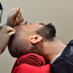 How Much Does a Hair Transplant Cost in Pakistan?