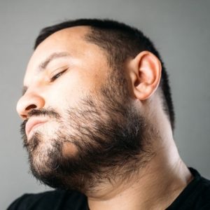 How much does beard transplant cost in Pakistan?