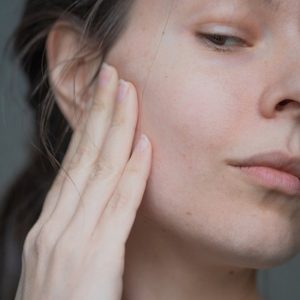 Acne Scars-How To Remove Them and Regain Your Confidence