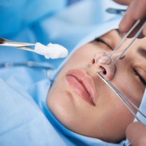 Non-Surgical Rhinoplasty with Thread In Islamabad