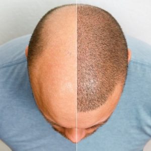 How much does SMP cost in Islamabad?