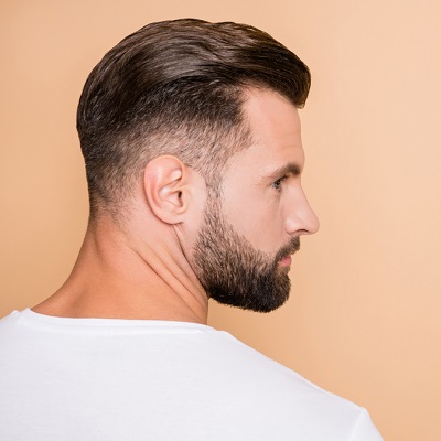 Hair Transplant For Brown Hairs In Islamabad