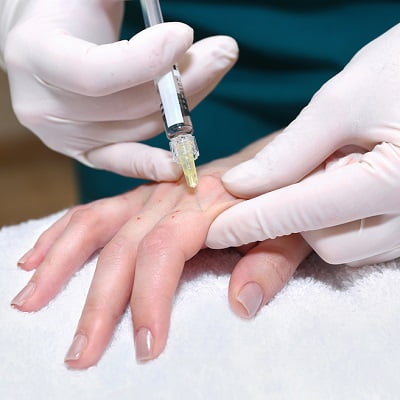 Hand Rejuvenation with Fat Transfer Surgery in Islamabad