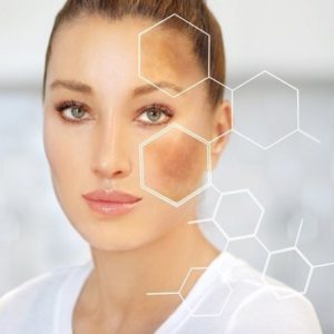 How Much Does It Cost To Remove Hyperpigmentation