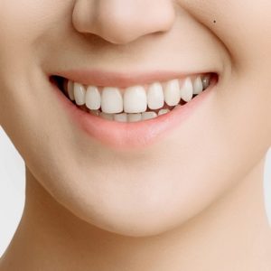 Dental Veneers Cost In Islamabad