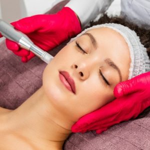 The Secrets to Micro Needling Treatment