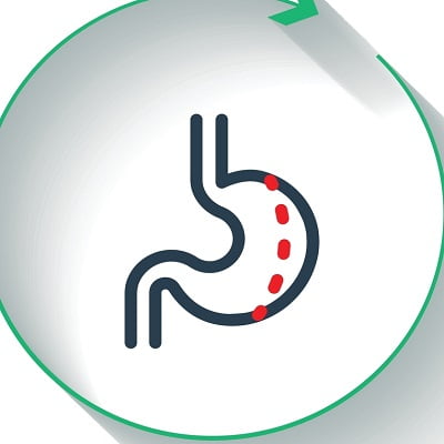 gastric plication cost in Islamabad