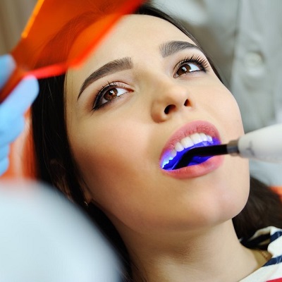 What You Should Know About The Different Types Of Dental Fillings