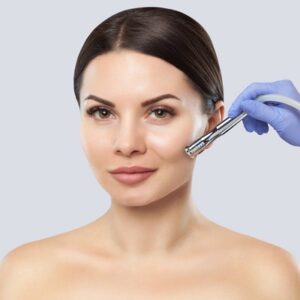 How often should I go for a diamond peel?