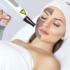 Laser Carbon Peels: Expectations vs. Reality