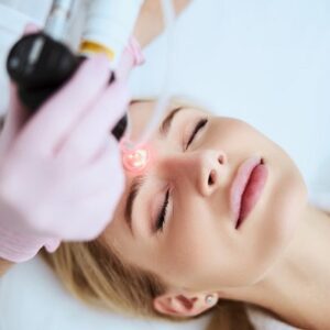 Incredible benefits of Fractional CO2 Skin Resurfacing Treatment in Islamabad. 