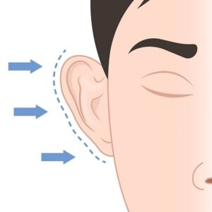 Learn the benefits of earlobe reduction surgery