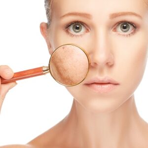 Everything you need to know about Dermal Pigmentation