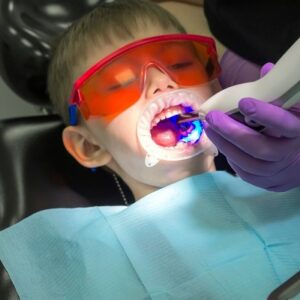 How laser root canal treatment is done?