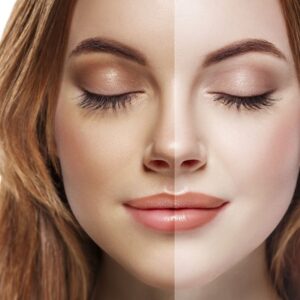 How to Remove Sun Tan From the Face at Clinic in Islamabad?