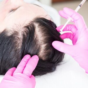 The Best Doctor for hair loss treatment in Islamabad