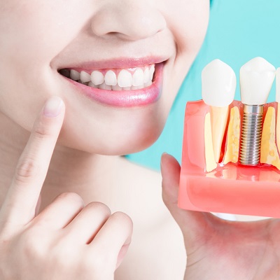 What is the Best Time for Teeth Implants?