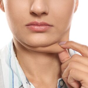 Grab the limited new year offer – Get rid of your double chin