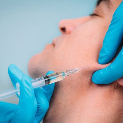 Everything you need to know about the most popular jawline filler