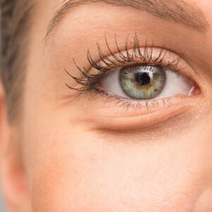 How To get rid of bags under your eyes