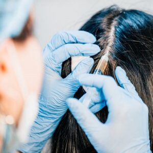 How long does hair restoration recovery in Islamabad take?