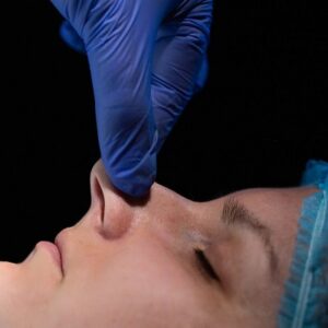 Nasal Tip plasty using various rhinoplasty techniques