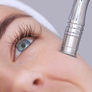 Can you see the results after one microdermabrasion treatment?