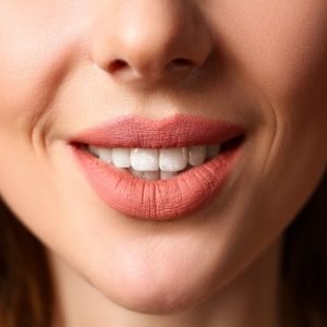 How Long-lasting Is The Cheek Implant Procedure?