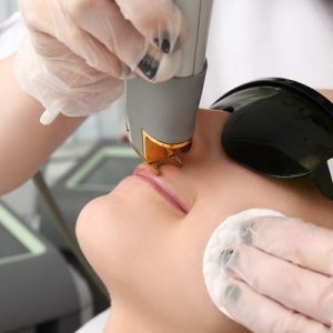 laser hair removal for face cost & procedure in Islamabad