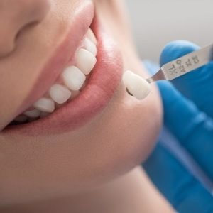 Why Would I Need a Dental Crown?