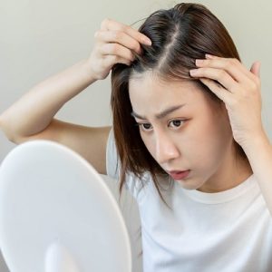 Top 3 Dos and Don’ts for Female Pattern Baldness