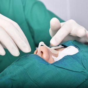 how long will silicone rhinoplasty last?