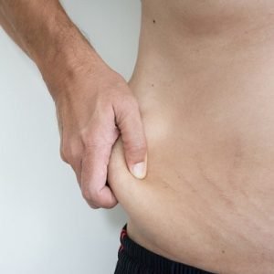 10 Things to Know Before Getting a Tummy Tuck