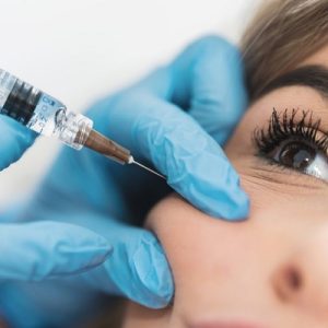 Are cheek implants are better than fillers?