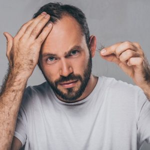 The Pros and Cons of Hair Loss Medications: Which One is Right for You