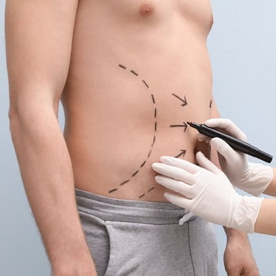 How much does liposuction cost in Islamabad Pakistan