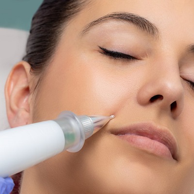 The Top Cosmetic Procedures for Reducing Fine Lines and Wrinkles