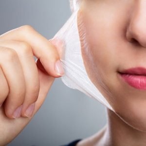 Chemical Peels for Hyperpigmentation: Fade Away Dark Spots