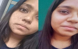 Glutathione in Islamabad