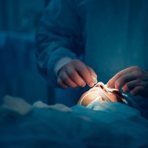 Rhinoplasty Myths vs Facts: The Real Truth Explained