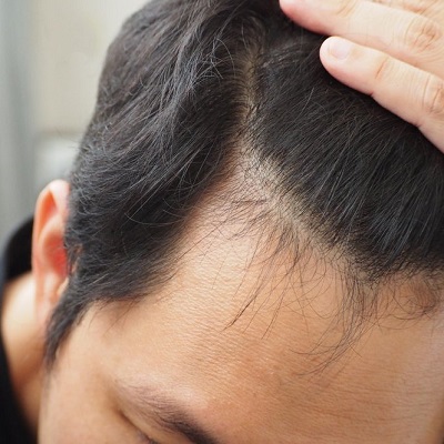 What are the top-rated hair growth treatments