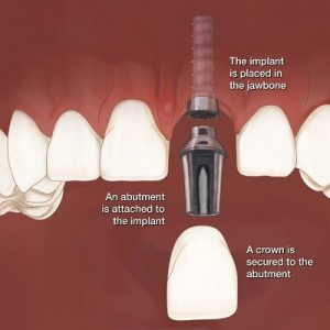 Are dental services expensive in Pakistan?
