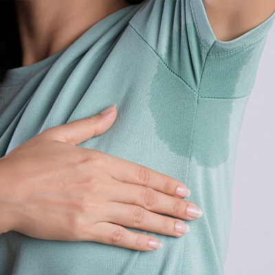 Beat the heat this summer with Hyperhidrosis treatment in Islamabad