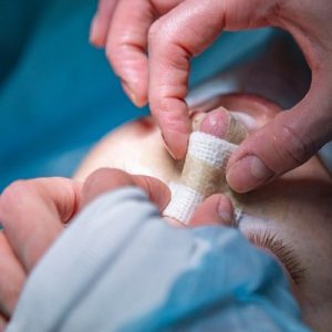 How much nose plastic surgery costs in Islamabad?