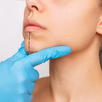 Is Jaw Surgery Painful?