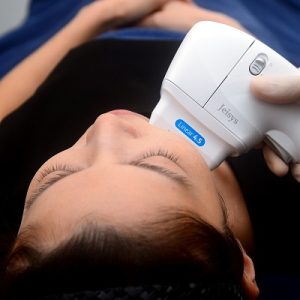 Lifting and Tightening Made Easy: Embracing the Benefits of HIFU