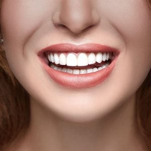 Transform Your Smile with Dental Veneers in Islamabad