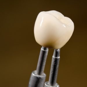 Which dental crown is the most realistic?
